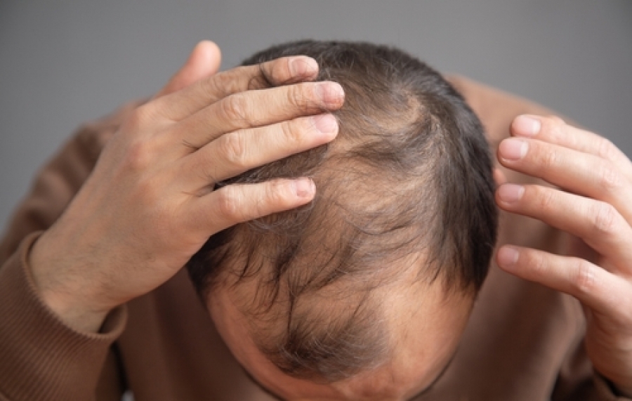 what are the best supplements for hair growth